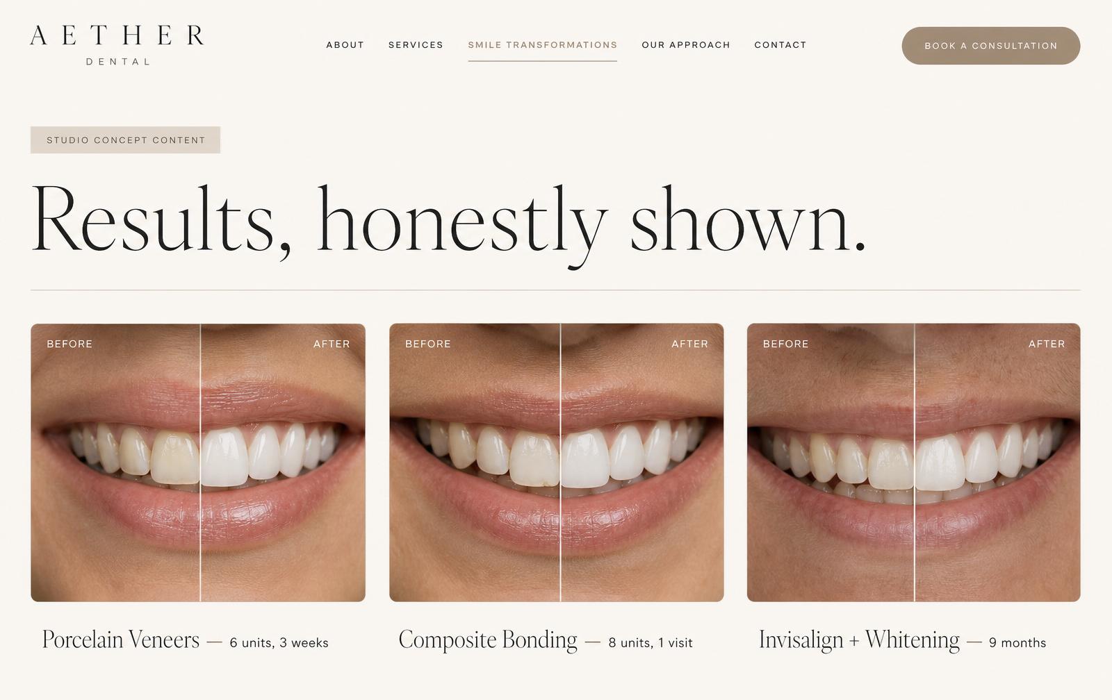 Aether Dental concept — Smile Transformations screen